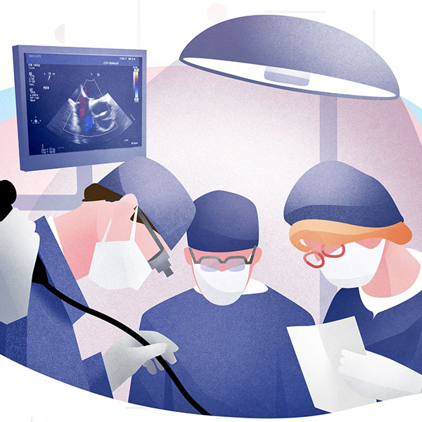 Ecocardiografía Intraoperatoria