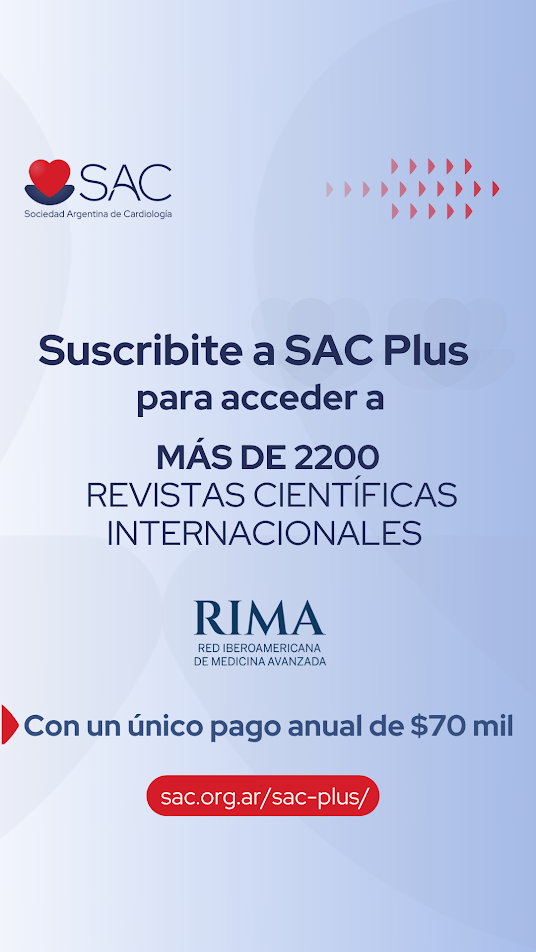SAC Plus